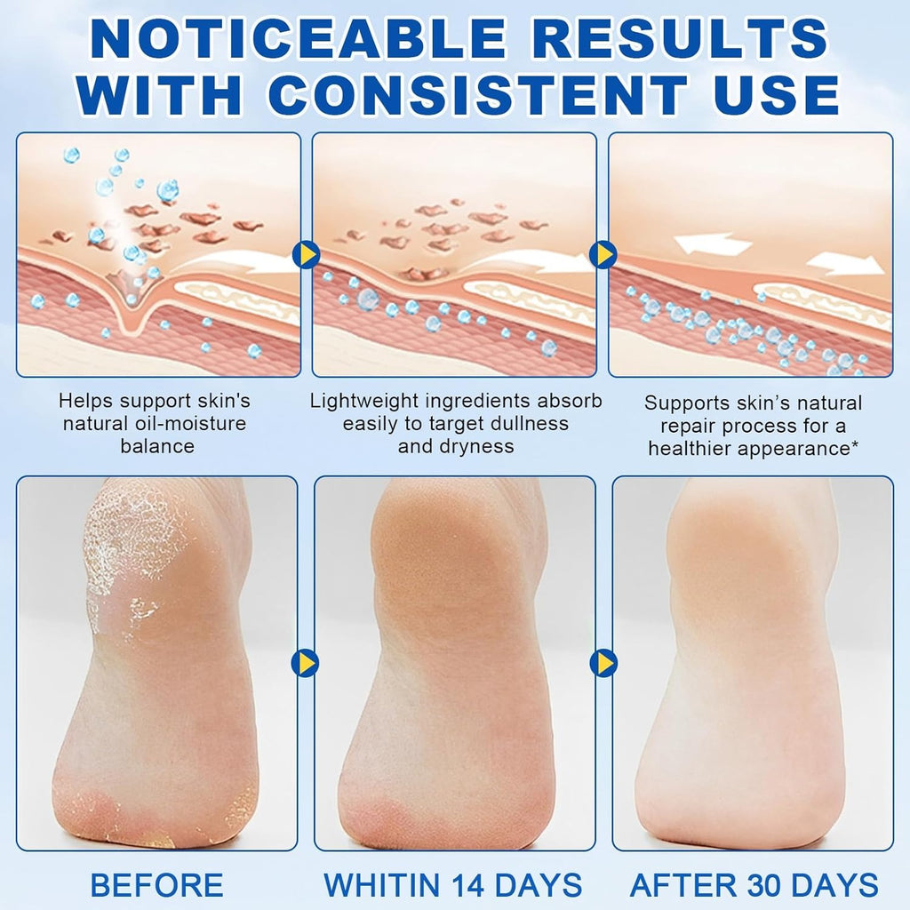 ELAIMEI 60% Urea Cream Stick