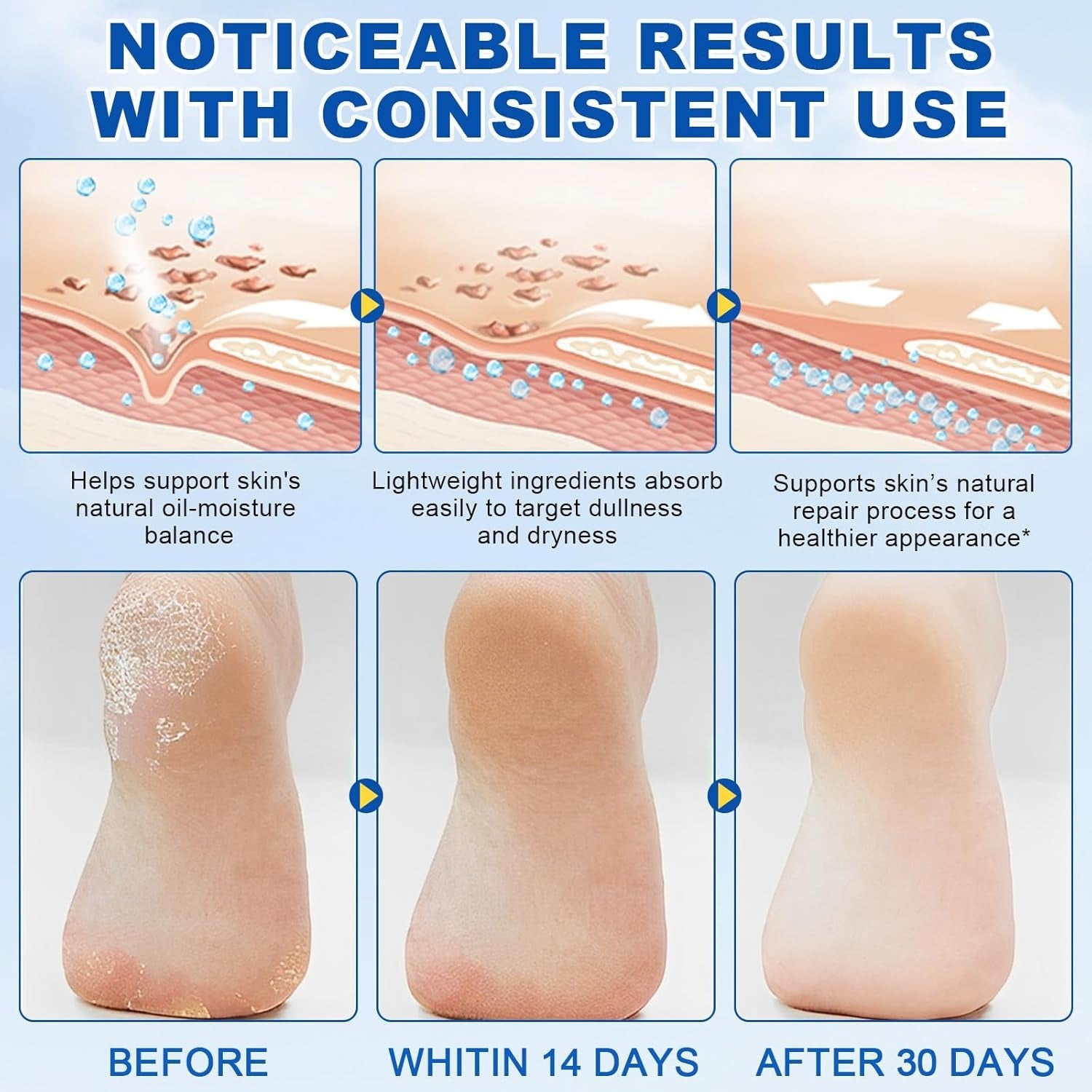 ELAIMEI 60% Urea Cream Stick